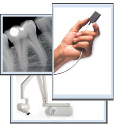 Radiologia-odontoiatrica-digitale-1