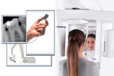 Radiologia odontoiatrica digitale, TAC 3D