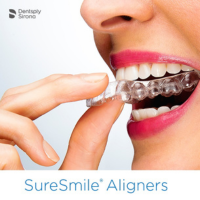 allineatori invisibili